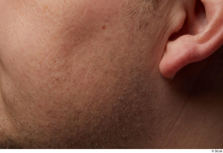 HD Face Skin Agustin Wilkerson cheek ear face skin pores…